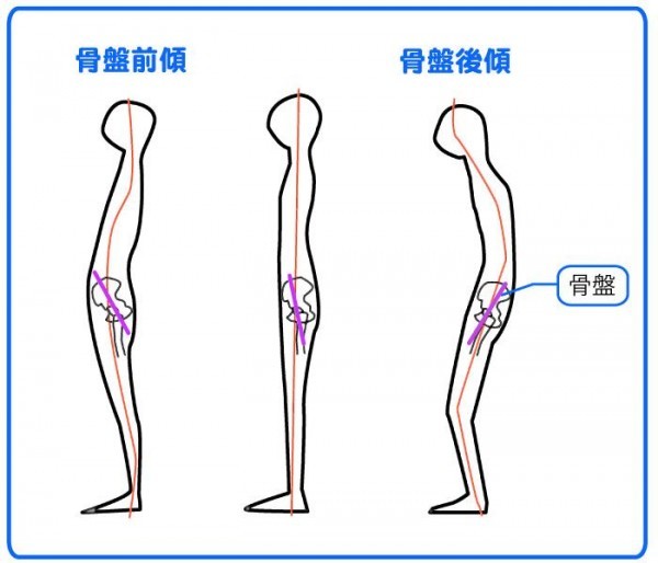 骨盤前傾後傾